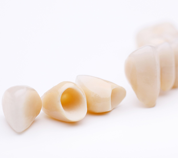 Atlanta Dental Crowns and Dental Bridges