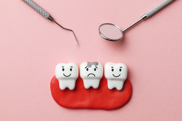 Dental Fillings: Early Intervention For Tooth Decay