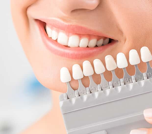 Atlanta Dental Veneers and Dental Laminates