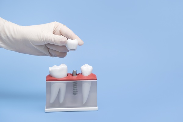 Is It Painful To Get A Tooth Implant?